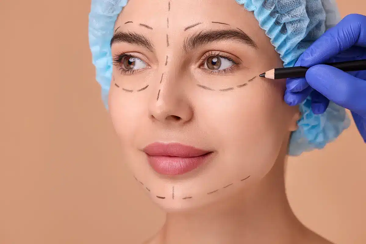 doctor drawing marks on womans face for cosmetic surgery operation